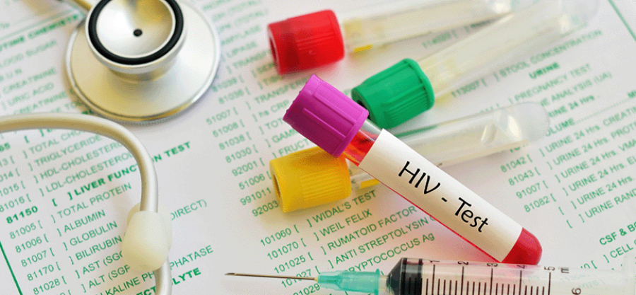 HIV-Test zur Einstellung bei Lufthansa endlich abgeschafft